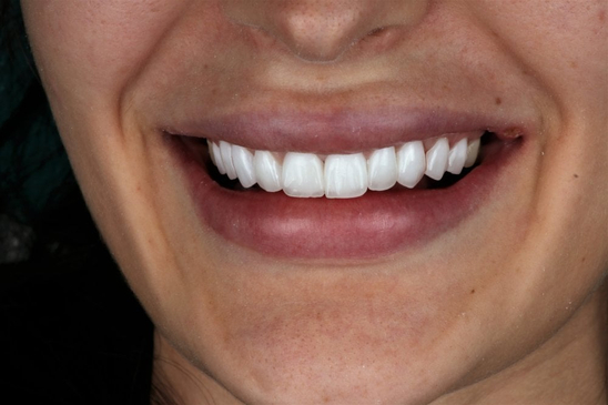 Slider image (2) Bright Way Dental Clinic